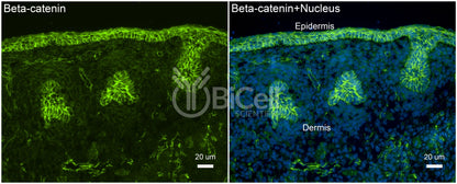 Beta-catenin (Ctnnb1) Antibody - Western Blot Validated