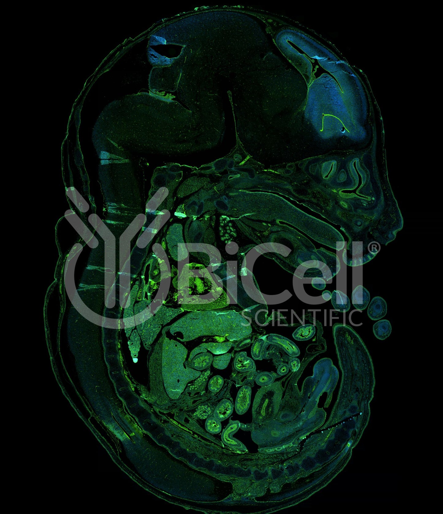 Beta-catenin (Ctnnb1) Antibody - FFPE Validated