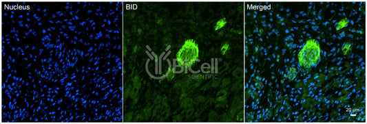 BID Antibody