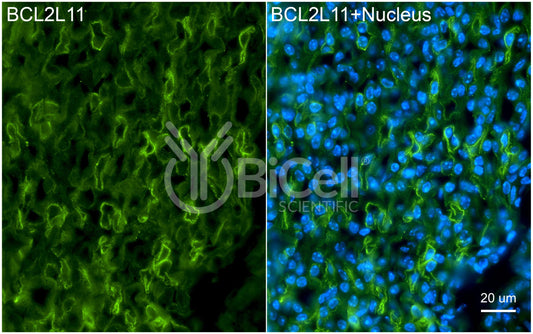 BCL2L11 (BAM or BIM) Antibody - FFPE Validated