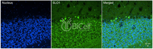 KCNMA1 (SLO1 or MaxiK or KCa1.1) Antibody