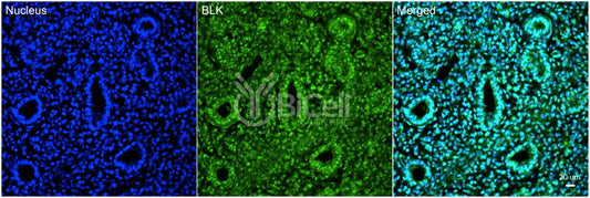 BLK Antibody - FFPE Validated