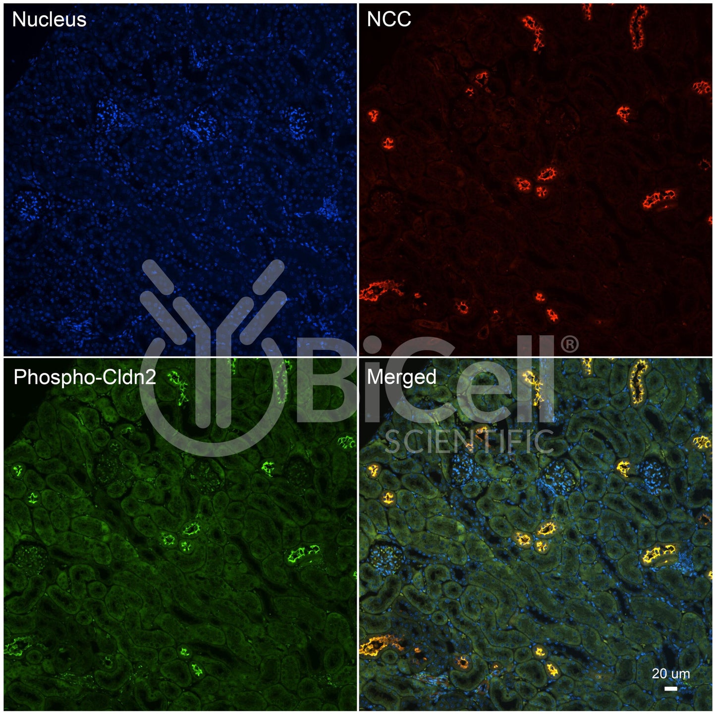 Claudin-2 (CLDN2) (Phospho-Ser208) Antibody - FFPE Validated