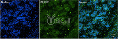 CX3CR1 (CCRL1 or GPR13) Antibody - FFPE Validated