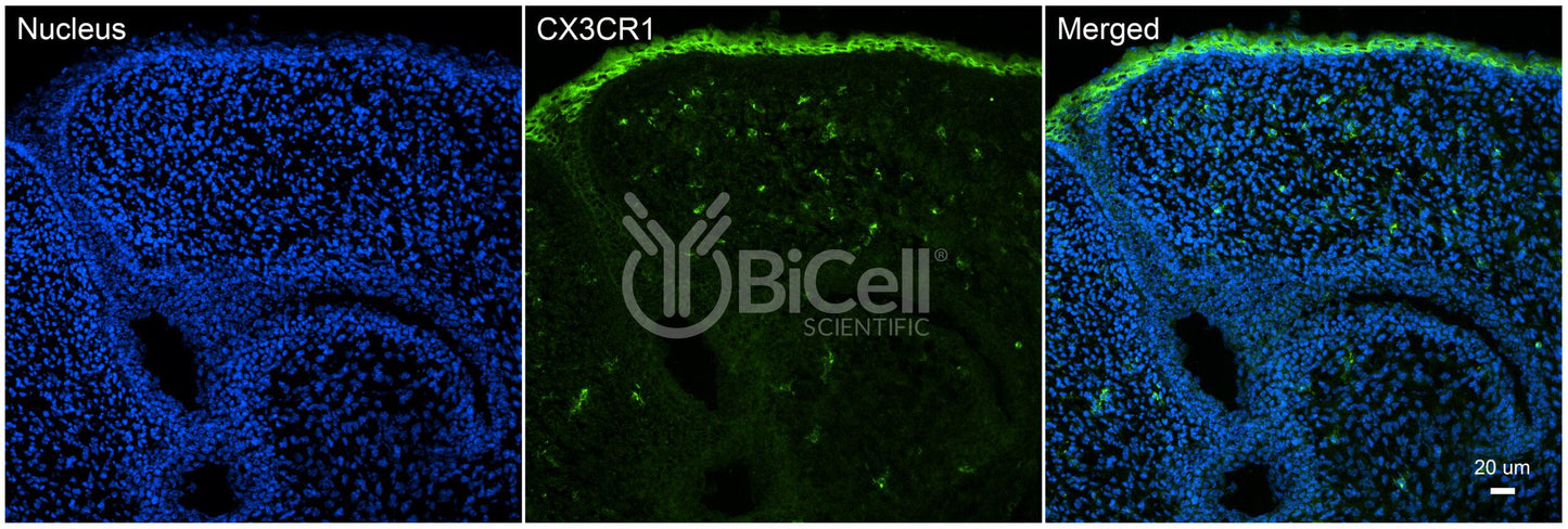 CX3CR1 (CCRL1 or GPR13) Antibody - FFPE Validated
