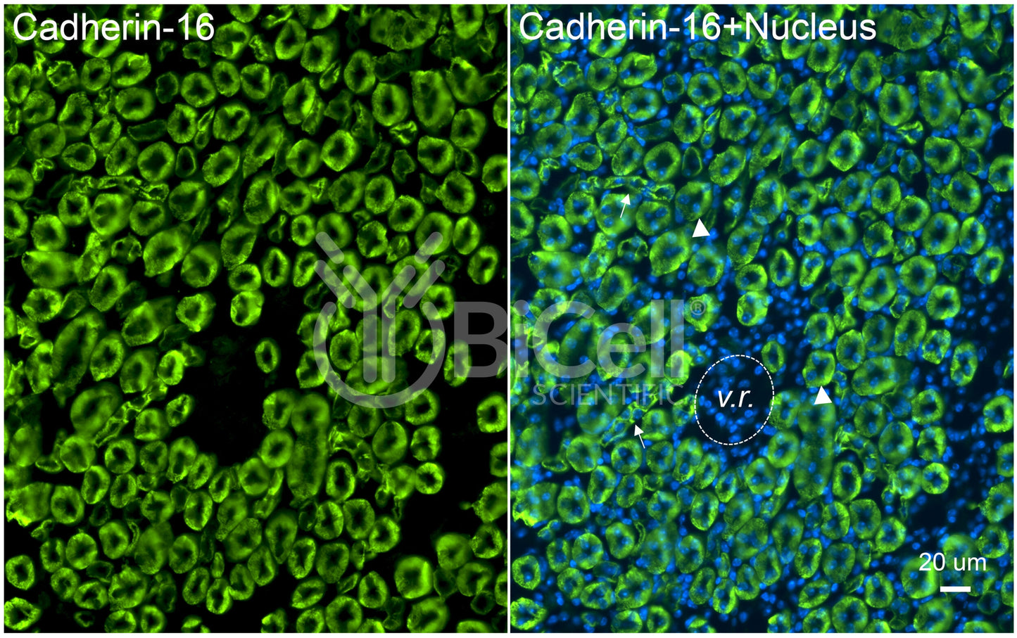 Cadherin-16 (Cdh16) Antibody