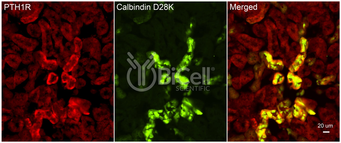 Calbindin-1 (CALB1 or Calbindin D-28K) Antibody