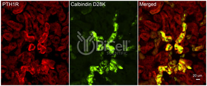 Calbindin-1 (CALB1 or Calbindin D-28K) Antibody