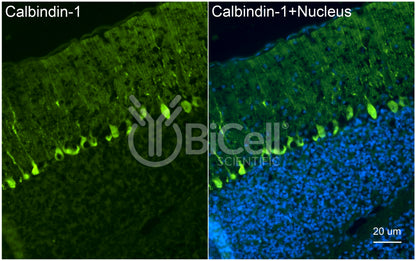 Calbindin-1 (CALB1 or Calbindin D-28K) Antibody - FFPE Validated