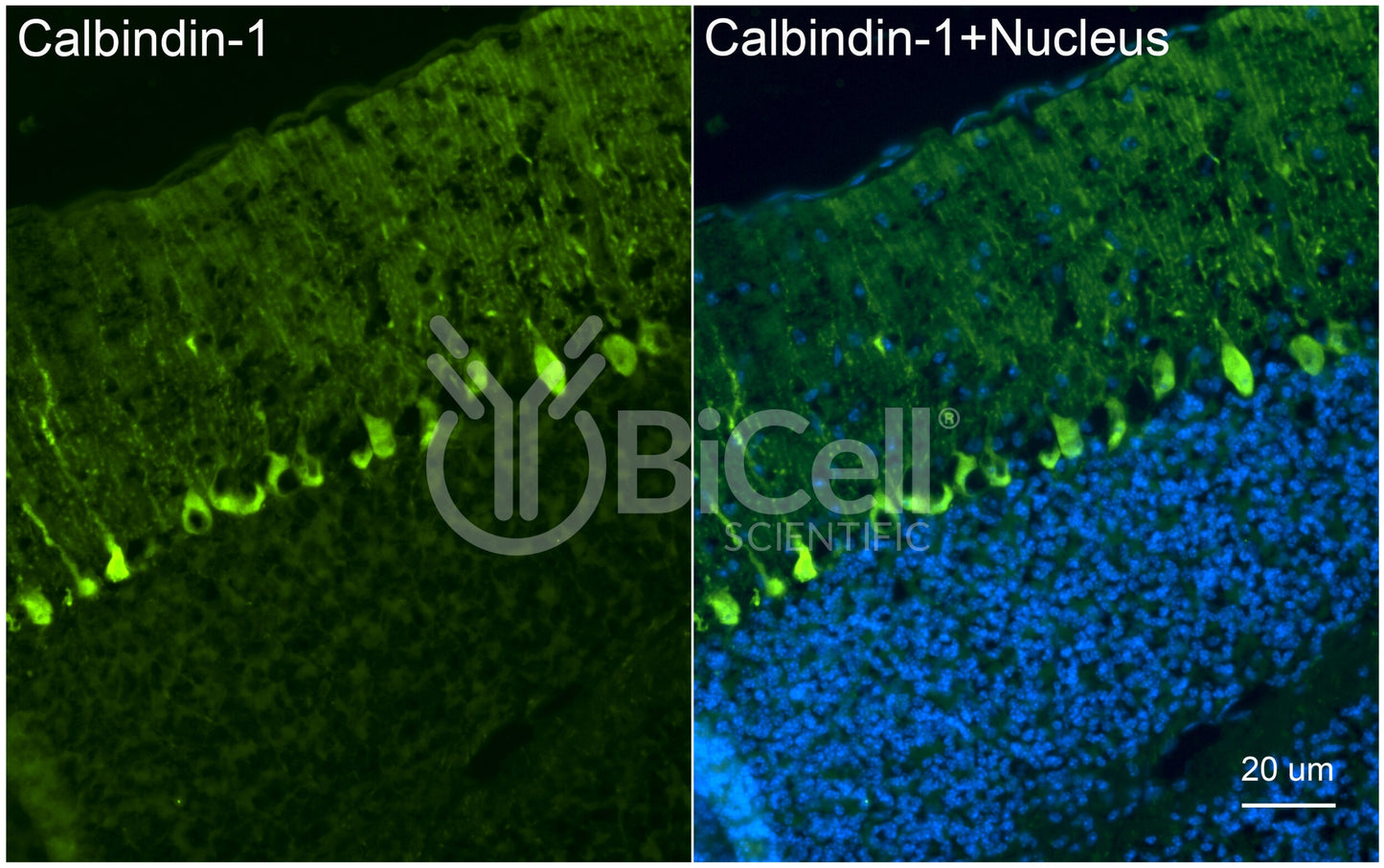 Calbindin-1 (CALB1 or Calbindin D-28K) Antibody