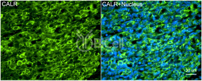 Calreticulin (CALR) Antibody