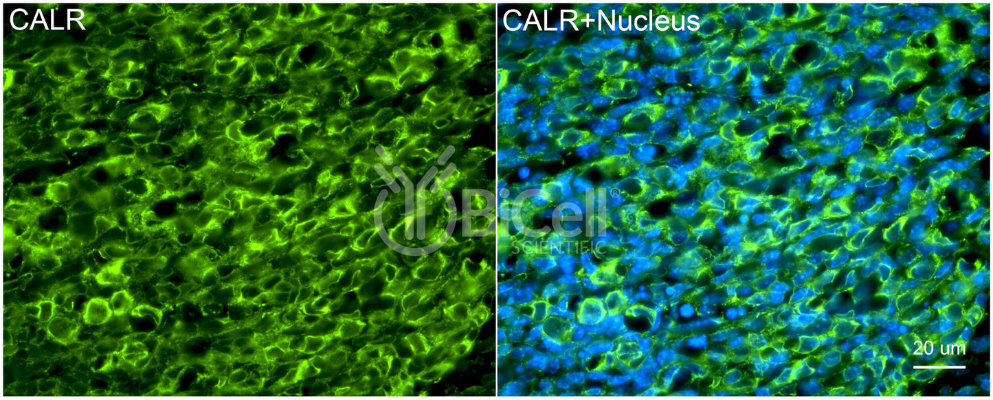 Calreticulin (CALR) Antibody - FFPE Validated