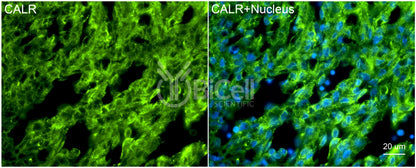 Calreticulin (CALR) Antibody - FFPE Validated