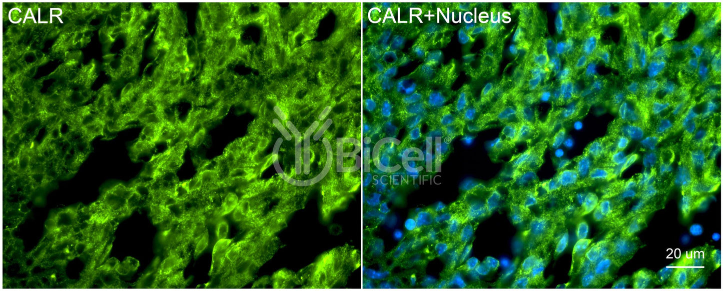 Calreticulin (CALR) Antibody