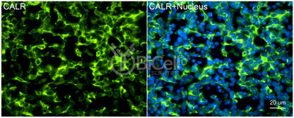 Calreticulin (CALR) Antibody