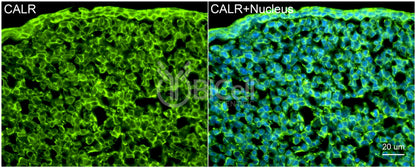 Calreticulin (CALR) Antibody - FFPE Validated