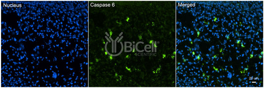 Caspase-6 (CASP6) Antibody