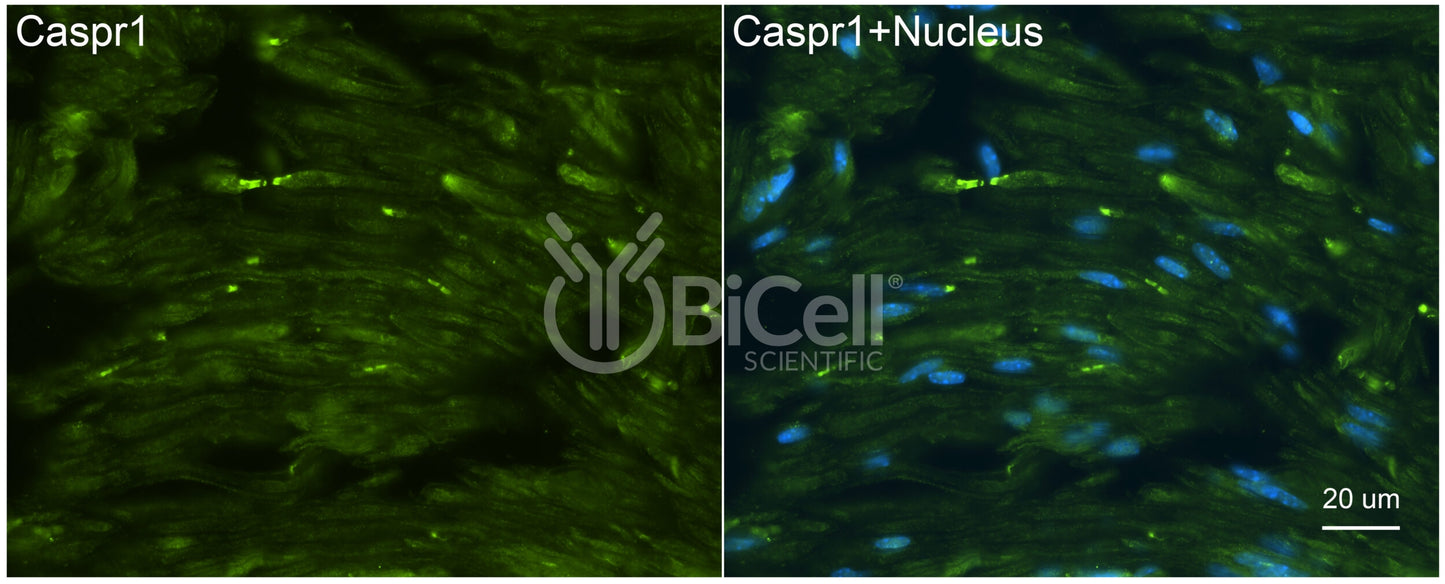 CASPR1 (CNTNAP1 or Paranodin) Antibody - FFPE Validated