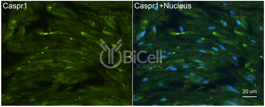 CASPR1 (CNTNAP1 or Paranodin) Antibody - FFPE Validated