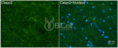CASPR2 (CNTNAP2) Antibody - FFPE Validated
