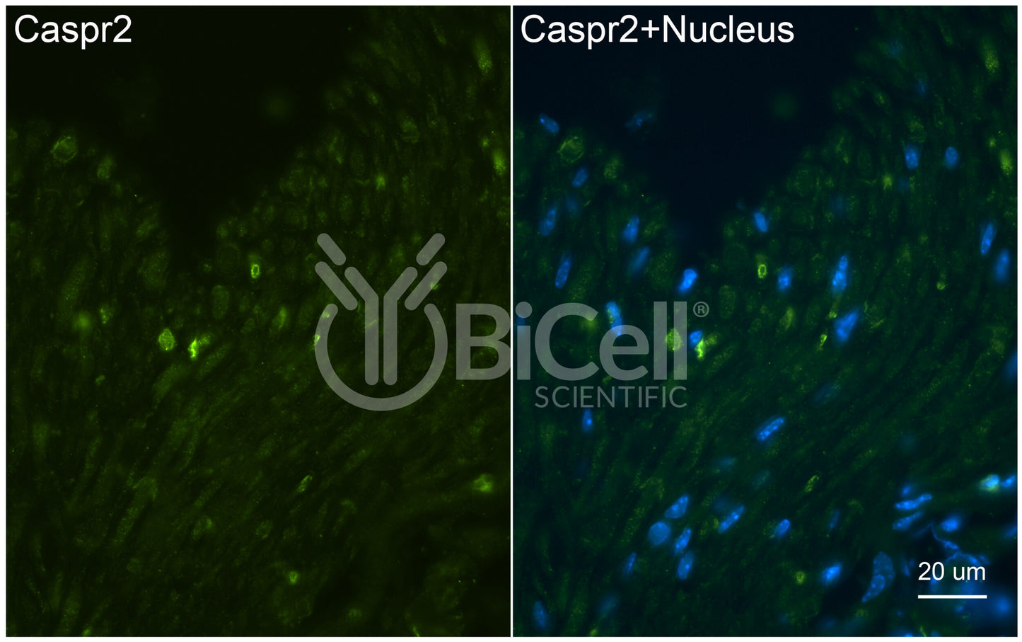CASPR2 (CNTNAP2) Antibody