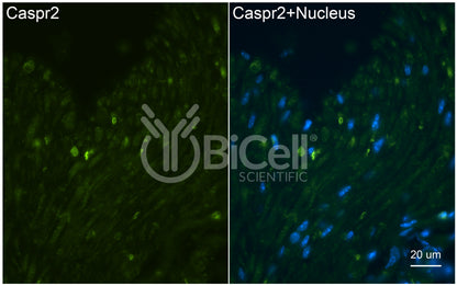 CASPR2 (CNTNAP2) Antibody