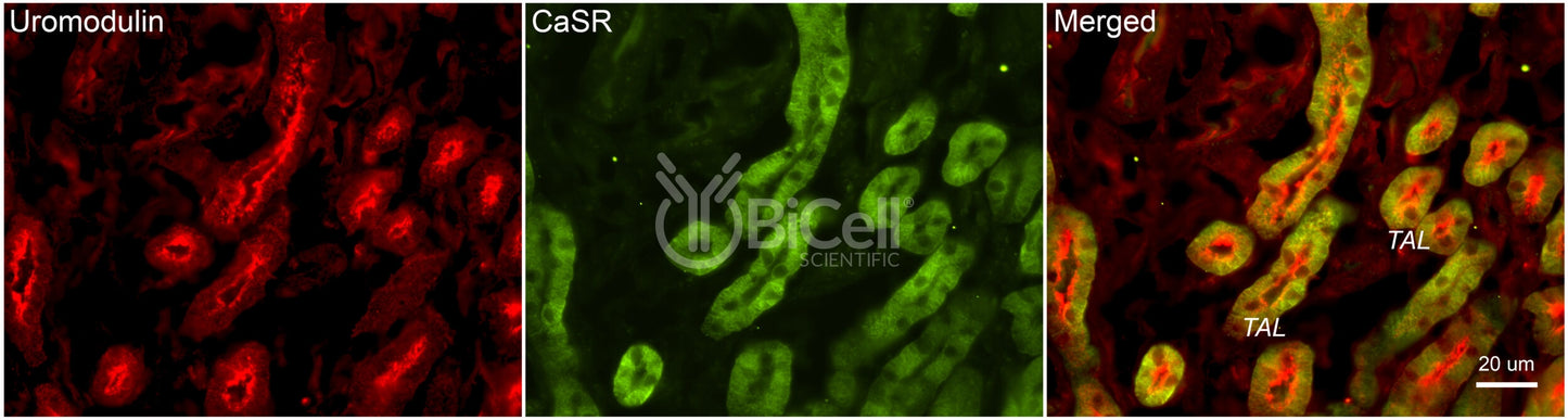 CaSR Antibody