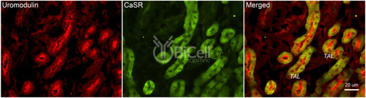 CaSR Antibody