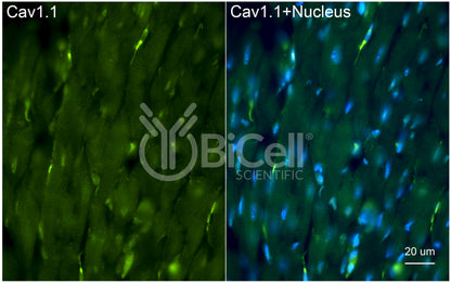 CACNA1S (Cav1.1) Antibody