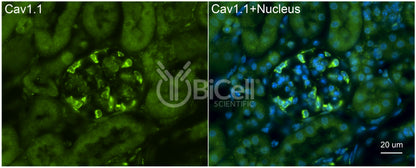CACNA1S (Cav1.1) Antibody - FFPE Validated