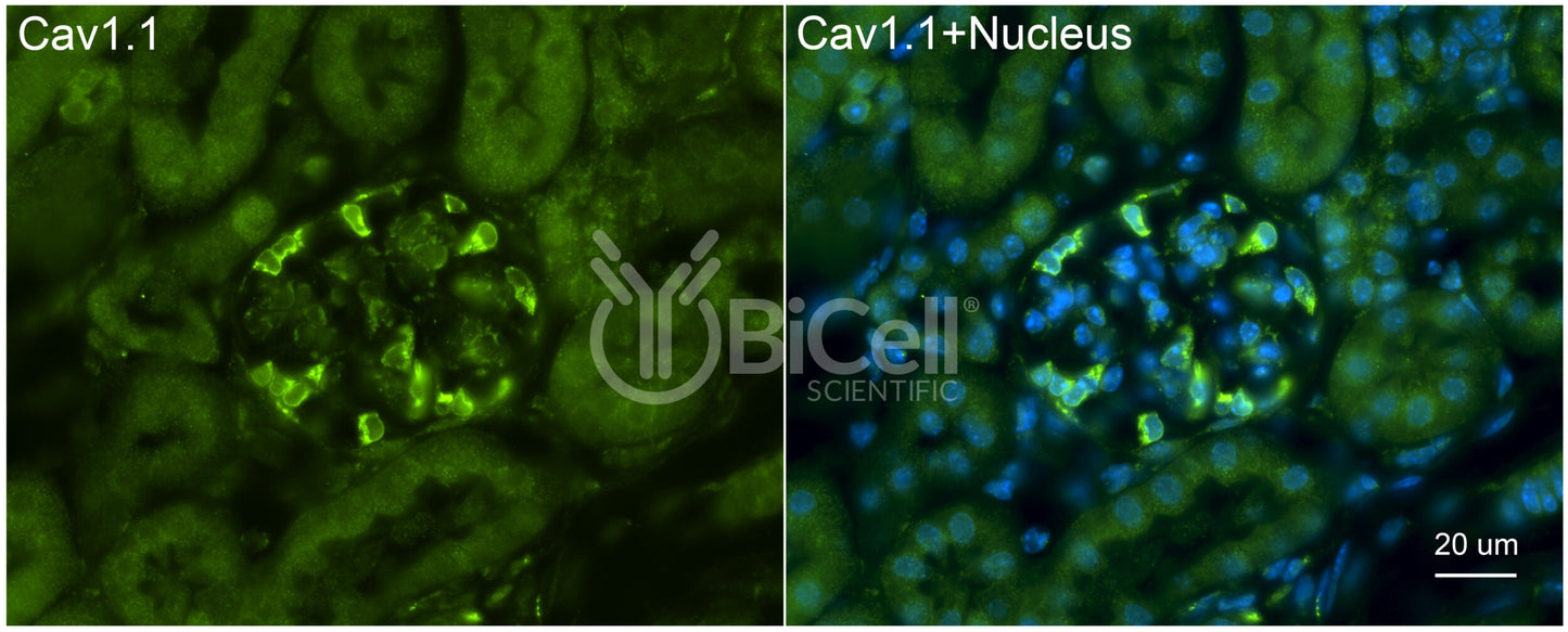 CACNA1S (Cav1.1) Antibody