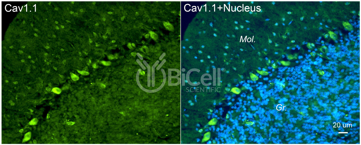 CACNA1S (Cav1.1) Antibody