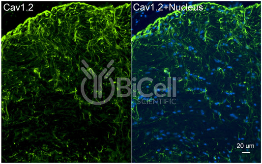 CACNA1C (Cav1.2) Antibody - Western Blot Validated