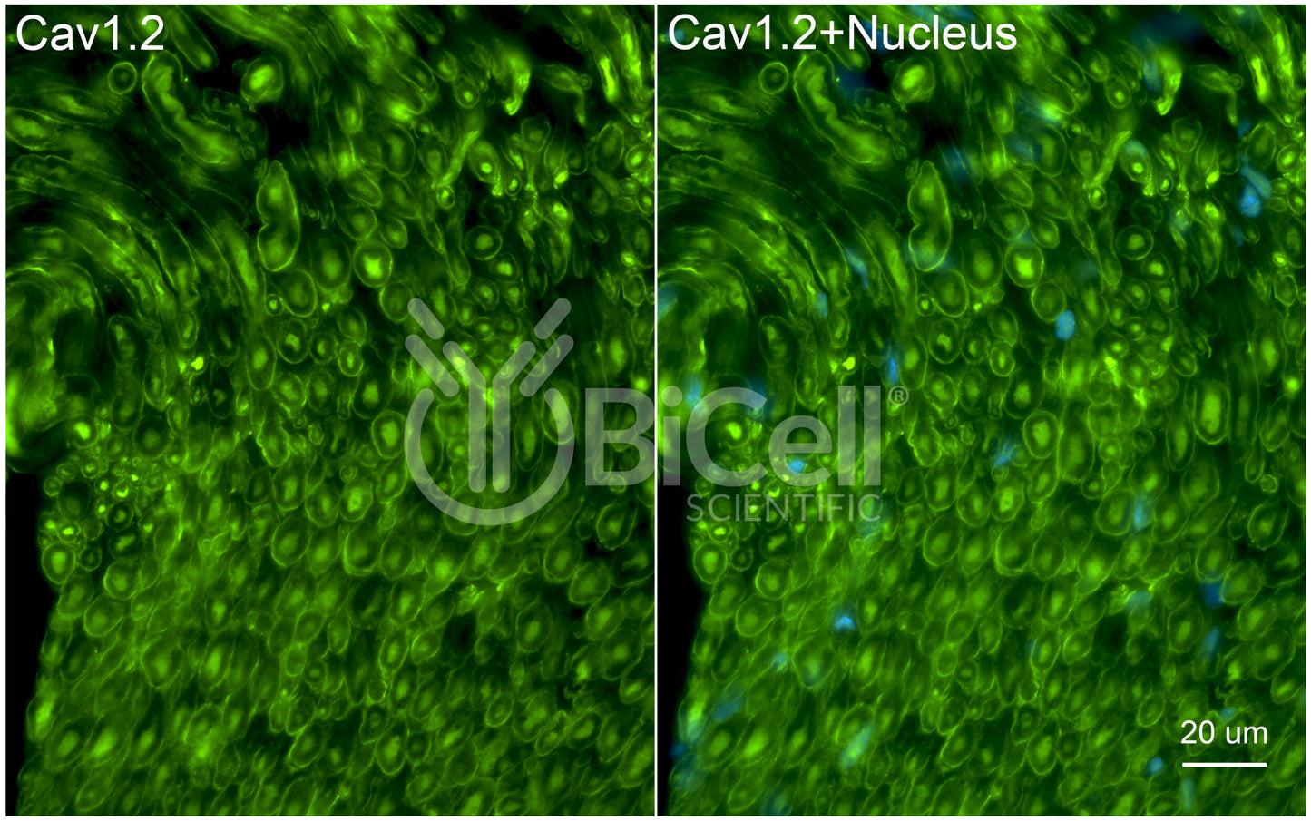 CACNA1C (Cav1.2) Antibody - FFPE Validated