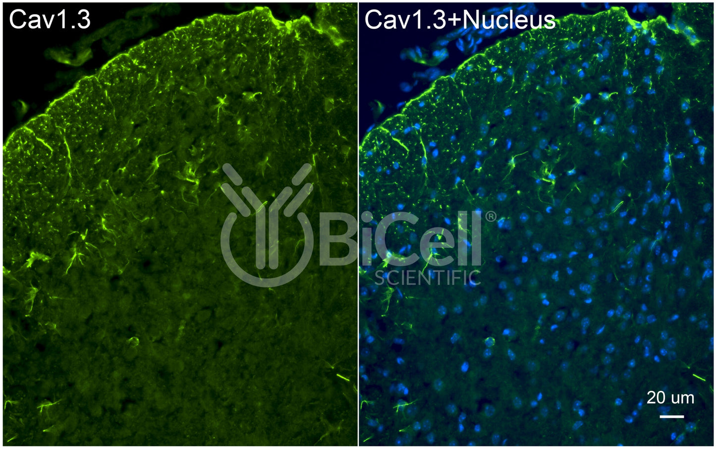 CACNA1D (Cav1.3) Antibody - FFPE Validated