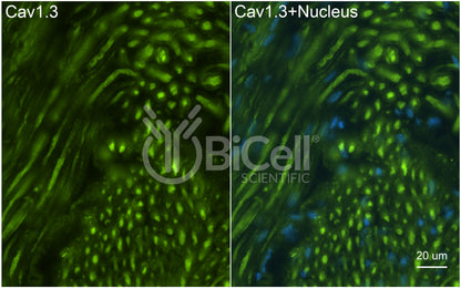 CACNA1D (Cav1.3) Antibody