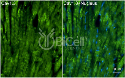 CACNA1D (Cav1.3) Antibody