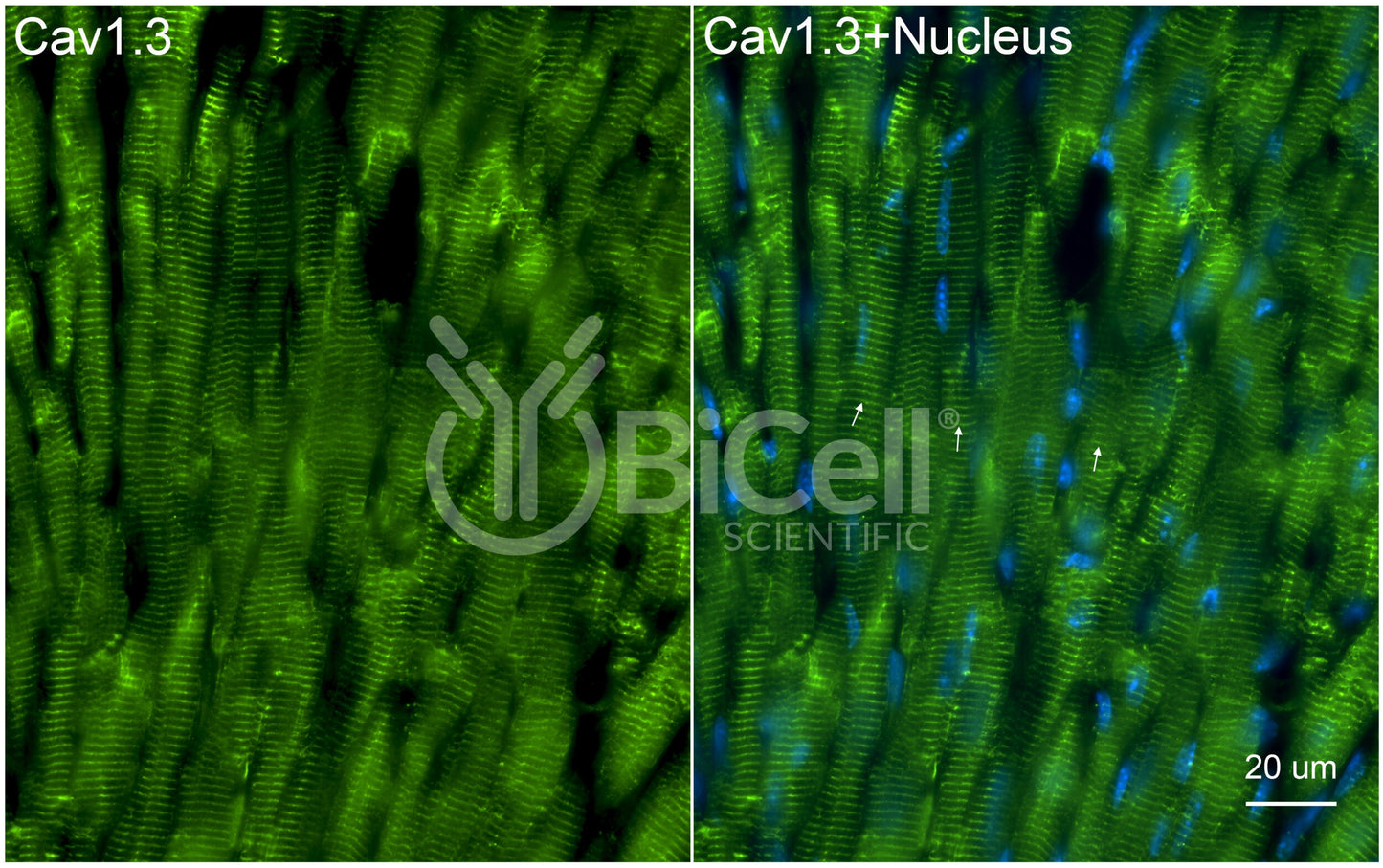CACNA1D (Cav1.3) Antibody - FFPE Validated