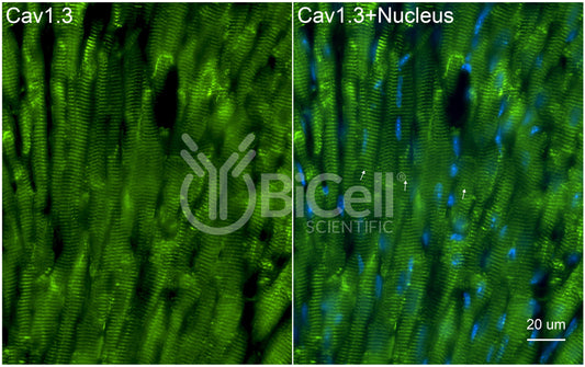 CACNA1D (Cav1.3) Antibody - FFPE Validated