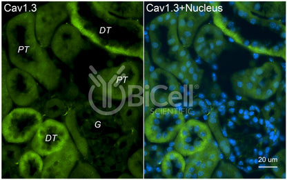 CACNA1D (Cav1.3) Antibody - FFPE Validated