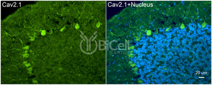 CACNA1A (Cav2.1) Antibody