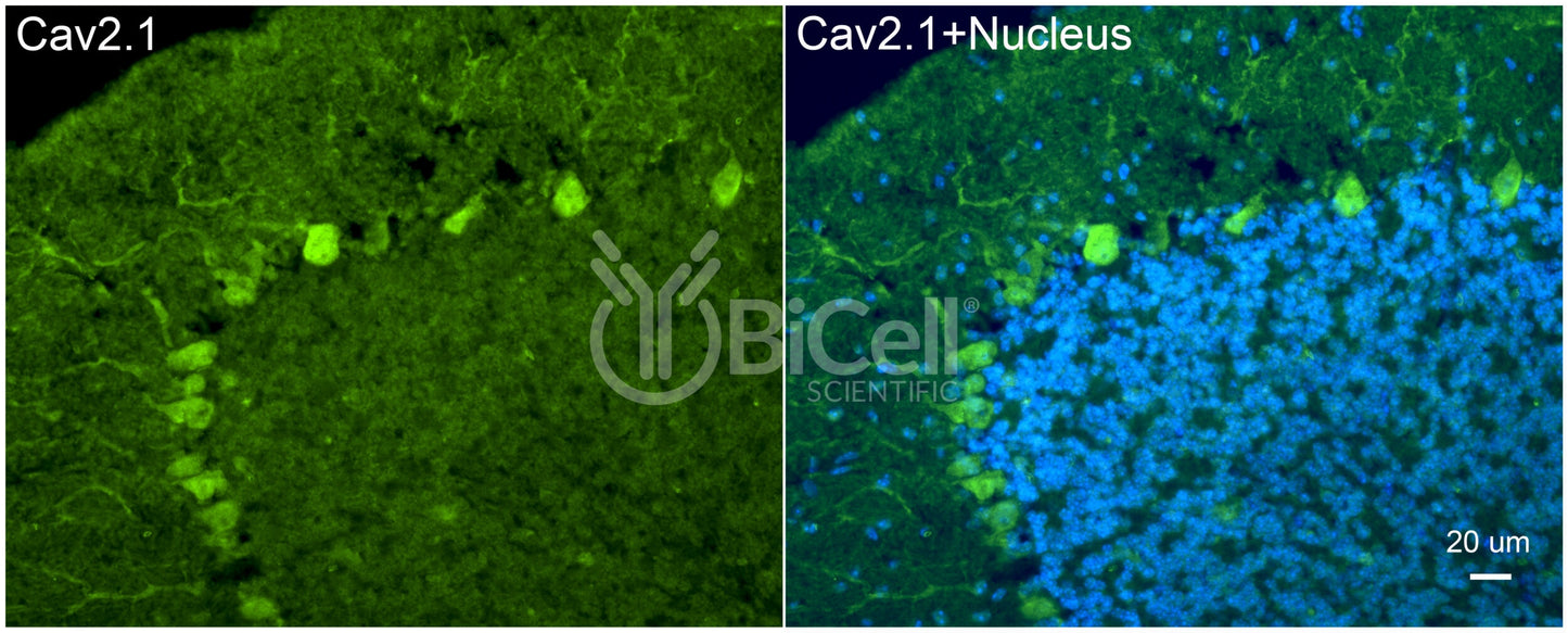 CACNA1A (Cav2.1) Antibody - FFPE Validated