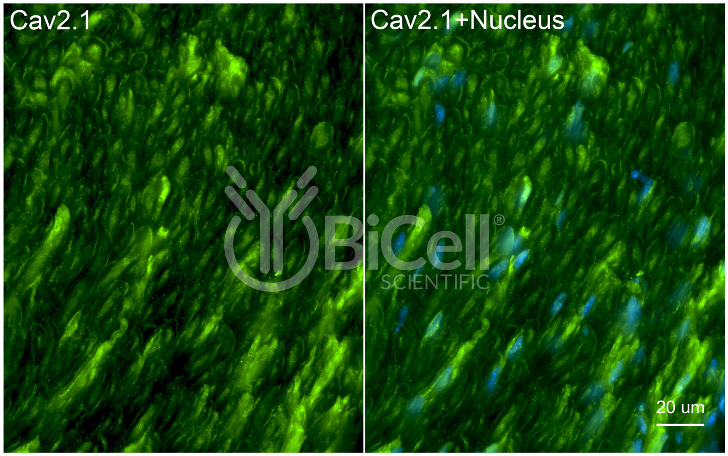 CACNA1A (Cav2.1) Antibody - FFPE Validated