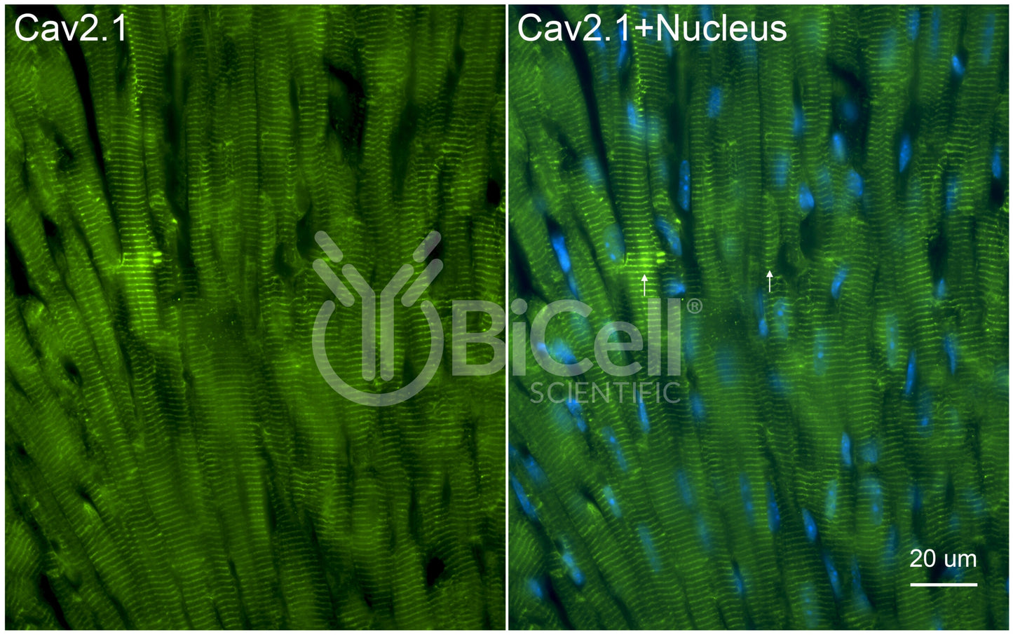 CACNA1A (Cav2.1) Antibody - FFPE Validated