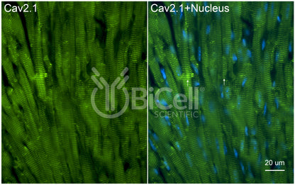 CACNA1A (Cav2.1) Antibody - FFPE Validated
