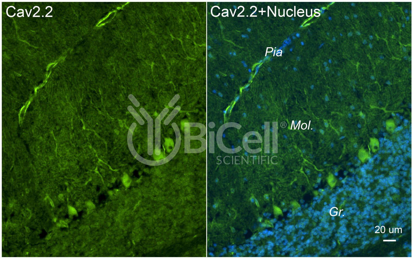 CACNA1B (Cav2.2) Antibody - Western Blot Validated