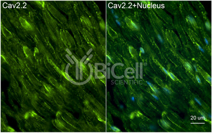 CACNA1B (Cav2.2) Antibody - Western Blot Validated