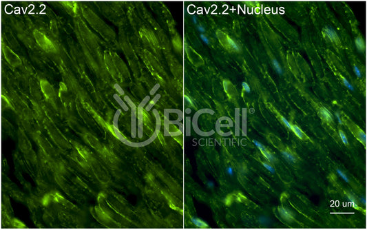 CACNA1B (Cav2.2) Antibody