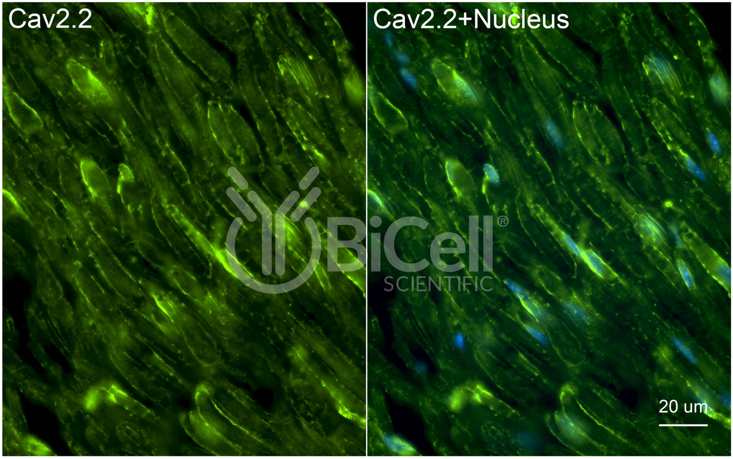 CACNA1B (Cav2.2) Antibody - FFPE Validated