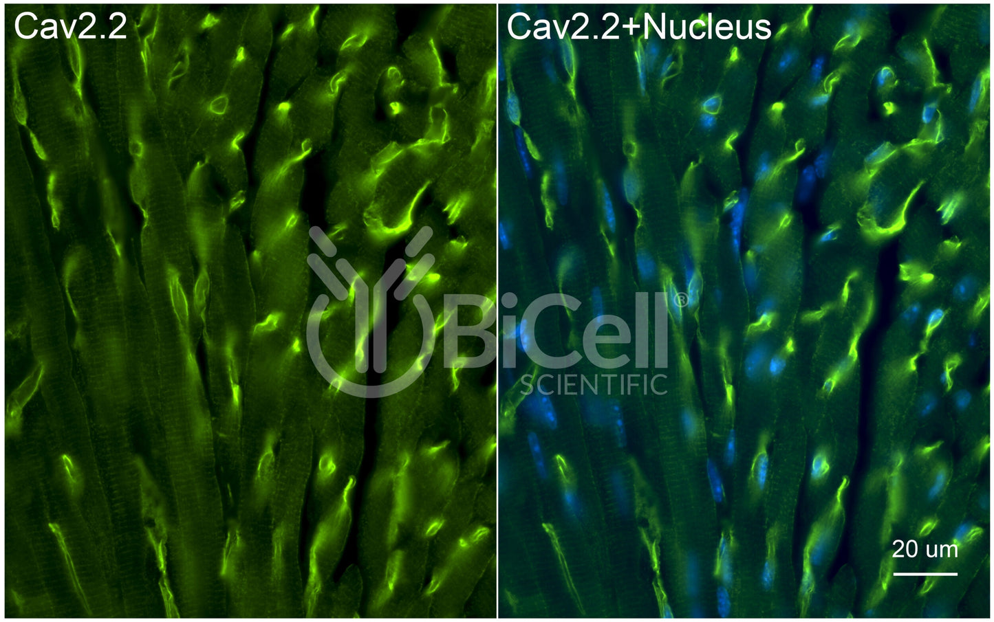 CACNA1B (Cav2.2) Antibody - Western Blot Validated